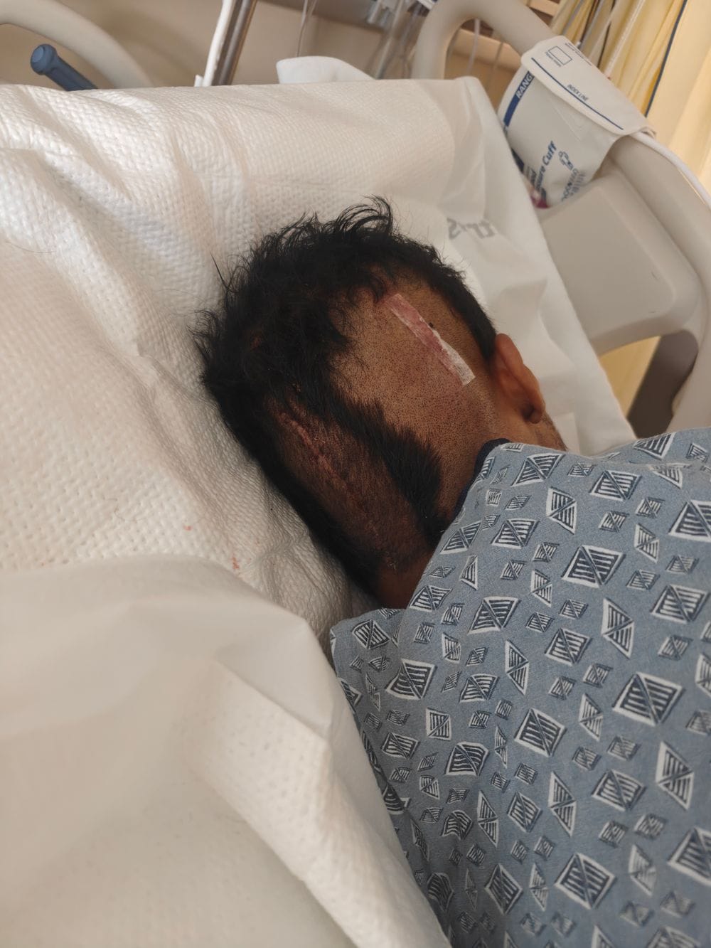 The incision at the base of Karamat's skull